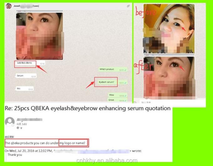 Większa długość obrzęków owych dzięki bioenzymom Wzrost rzęs Serum Czas trwania 3 lata 2