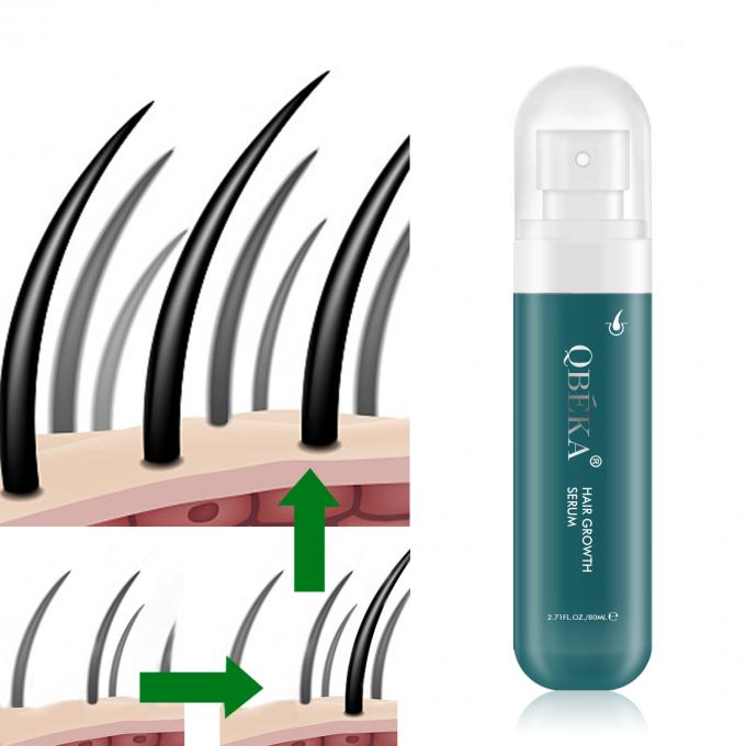 80 ml oleju do wzrostu włosów Produkt z prywatną etykietą 0