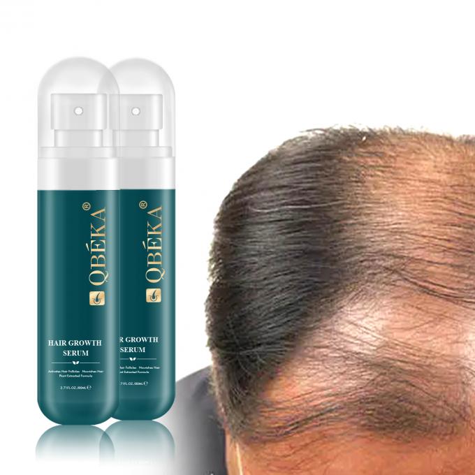 80 ml oleju do wzrostu włosów Produkt z prywatną etykietą 3