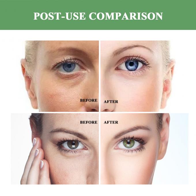 Regular Size Anti Aging Moisturizer Organic Natural Wrinkle Lifting Cream dla dorosłych 7
