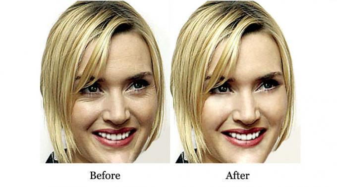 Zalety preparatu QBEKA Protein Peptide Serum Retencja wody i naprawa blizn trądziku 10 ml 7