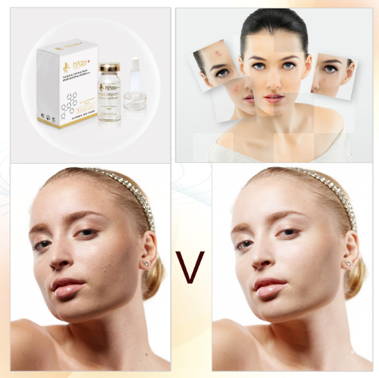 Rozmiar normalny Organic Vitamin C Oczyszczający Białko Anti freckles Ampułki Ilość 1000 1