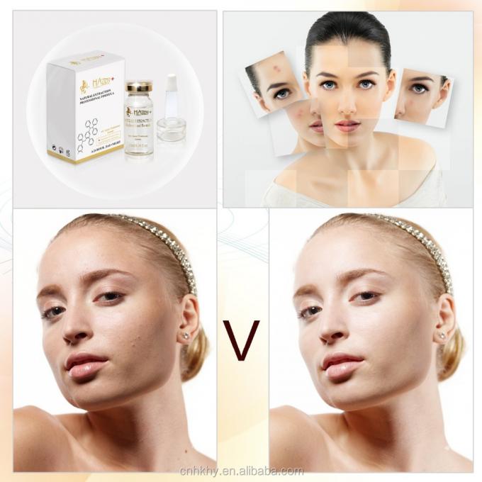 Usuń blizny od trądziku za pomocą QBEKA Happy Cosmetics Levorotatory VC Original Liquid Bio Serum 0